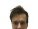 Проктолог Галицкий Александр Владимирович